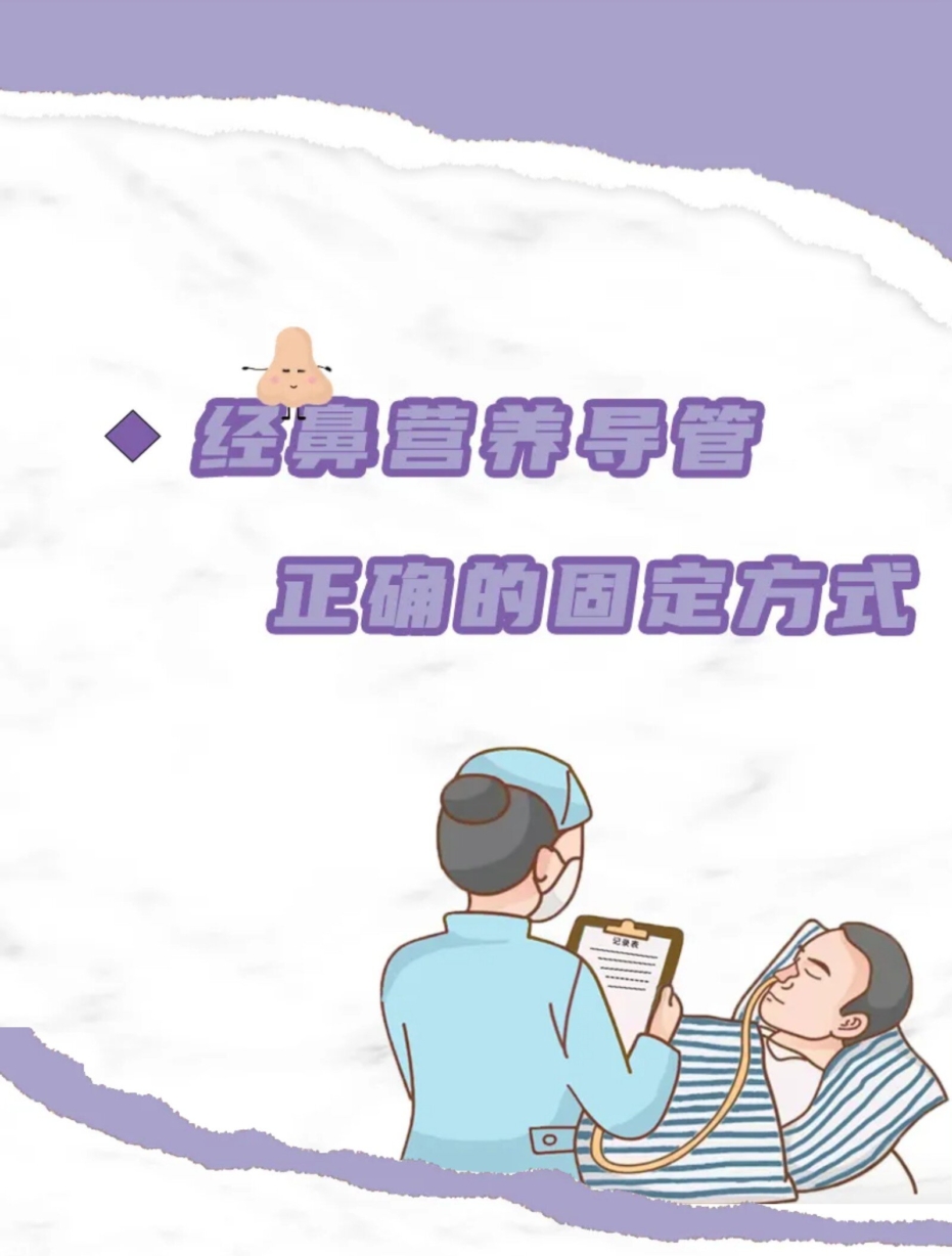 经鼻营养导管正确的固定方式