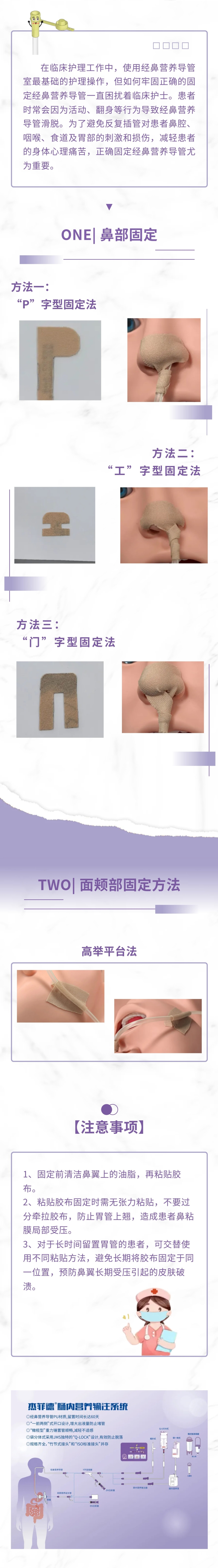 经鼻营养导管正确的固定方式